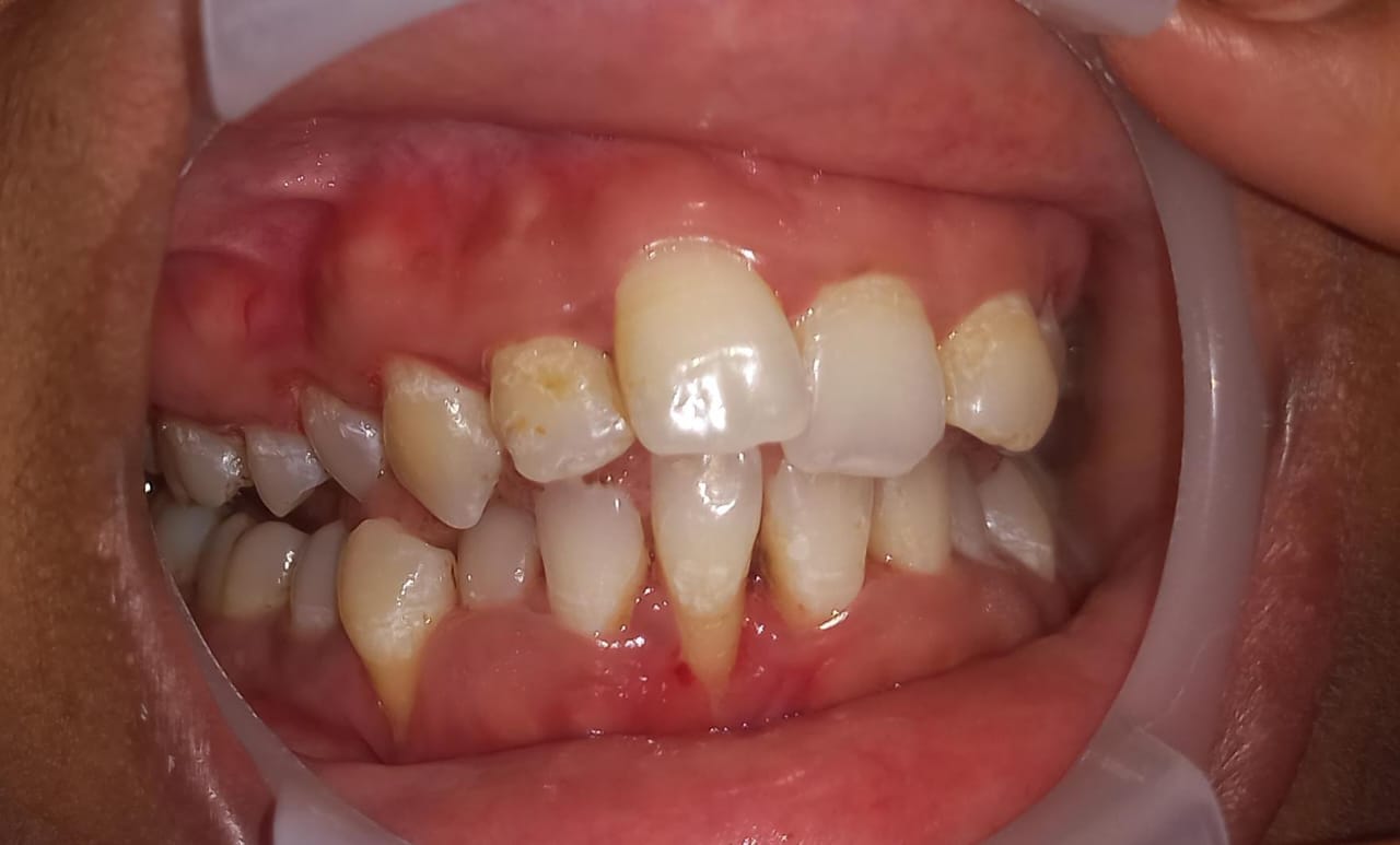 Awareness drive image 3